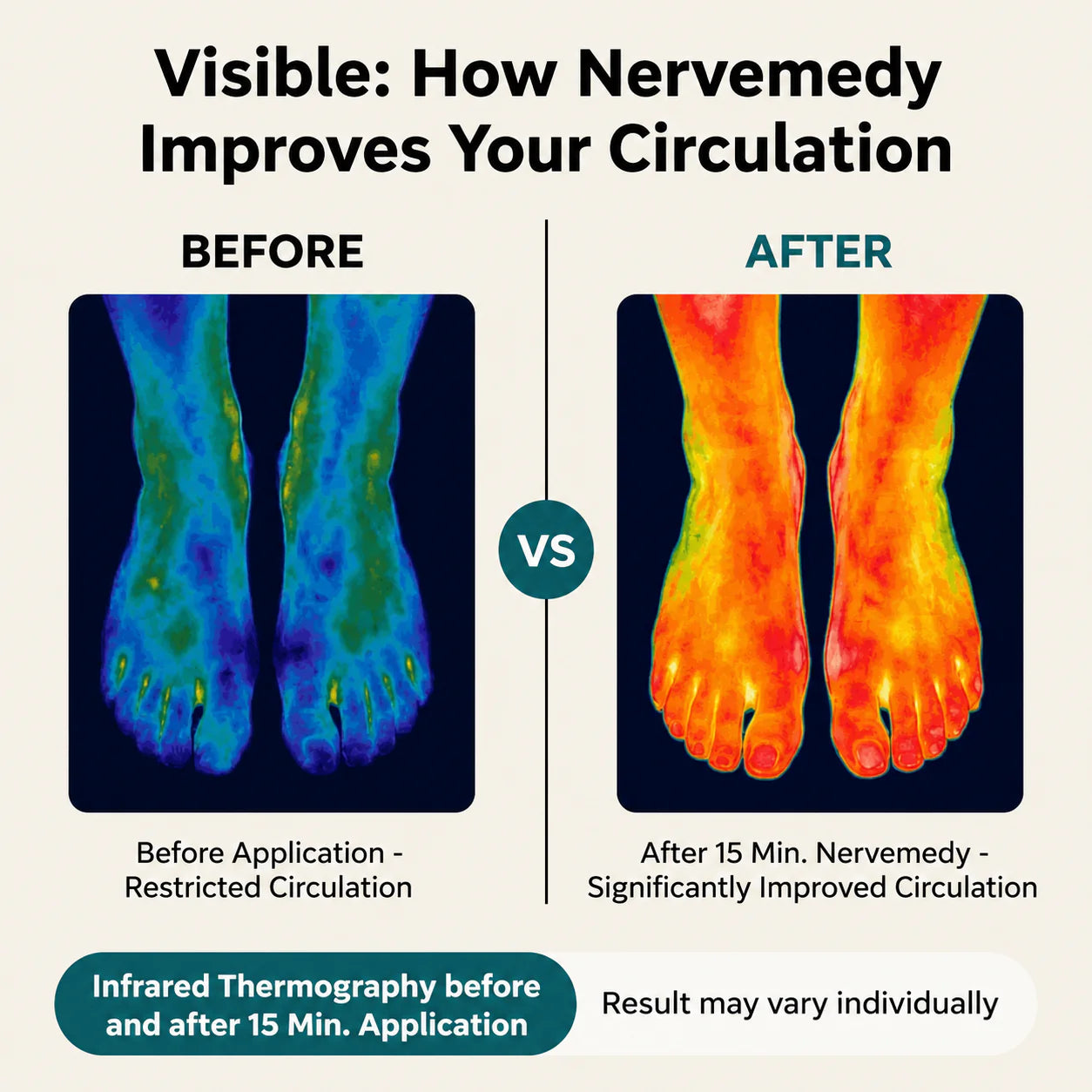 Nervemedy™ 3D NMES Foot Massager